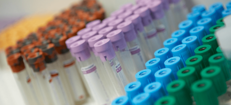 Imagen de archivo de unas pruebas de diagnóstico de viruela del mono / TA